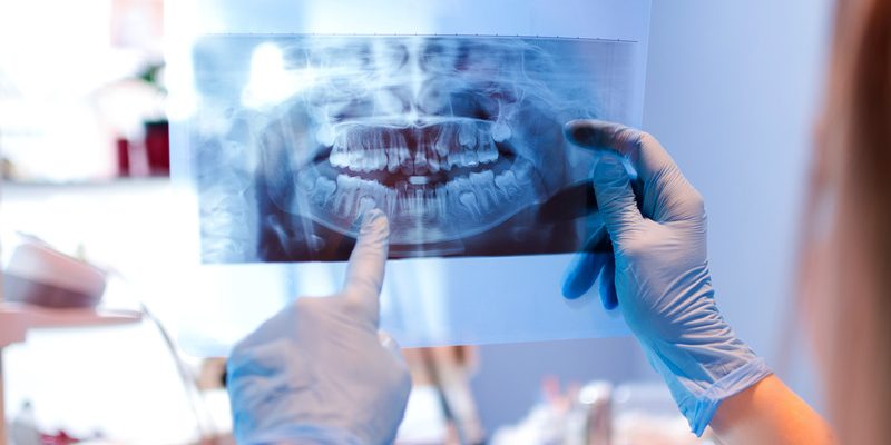 Close-up of female doctor pointing at teeth x-ray image at dental office.